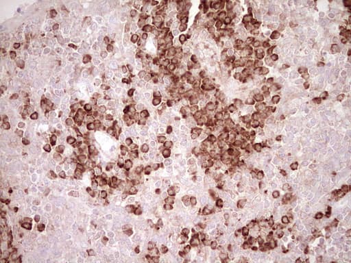 Monoclonal Mouse anti-Human BHLHE41 / BHLHB3 / SHARP1 Antibody (clone OTI7E8, aa1-297, IHC, WB)