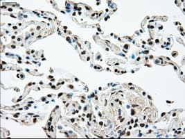 Monoclonal Mouse anti-Human MAP2K4 / MKK4 Antibody (clone OTI2E4, IHC, IF, WB)