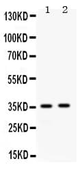APOE / Apolipoprotein E Antibody