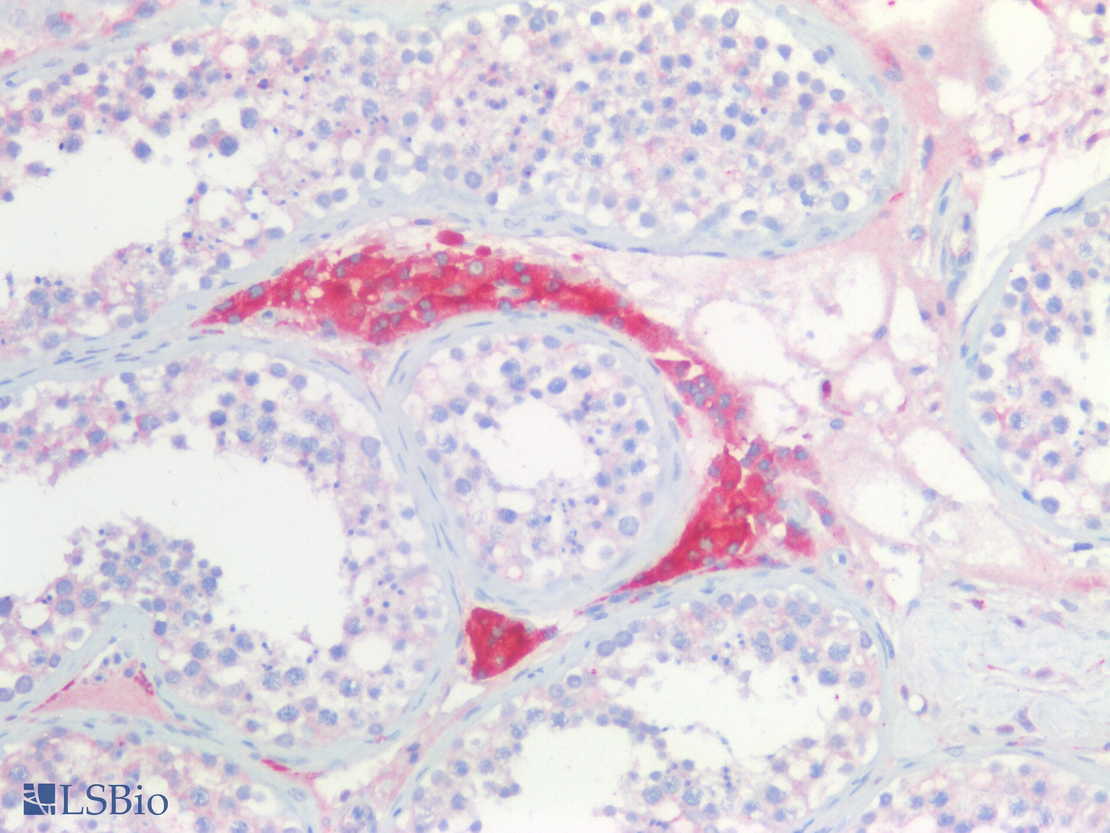 IHC-plus™ NCAM / CD56 Antibody (aa353-366)