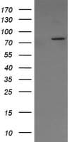 SOLO / SESTD1 Antibody (clone OTI4B10)