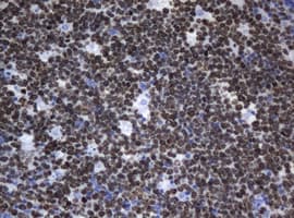 MKI67 / Ki67 Antibody (clone OTI5B10)