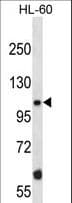 TAOK2 / TAO2 Antibody (aa415-443)