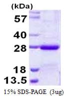 Human NKIRAS2 Protein (Recombinant His)