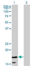 CALML5 Antibody (clone 2F10)