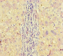 Polyclonal Rabbit anti-Human APOBEC3G / CEM15 Antibody (IHC, IF)