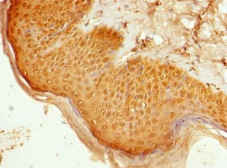 SEMA3B / SemA Antibody