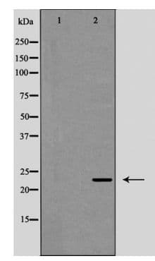 Polyclonal Rabbit anti-Human IL12A / p35 Antibody (IHC, WB)