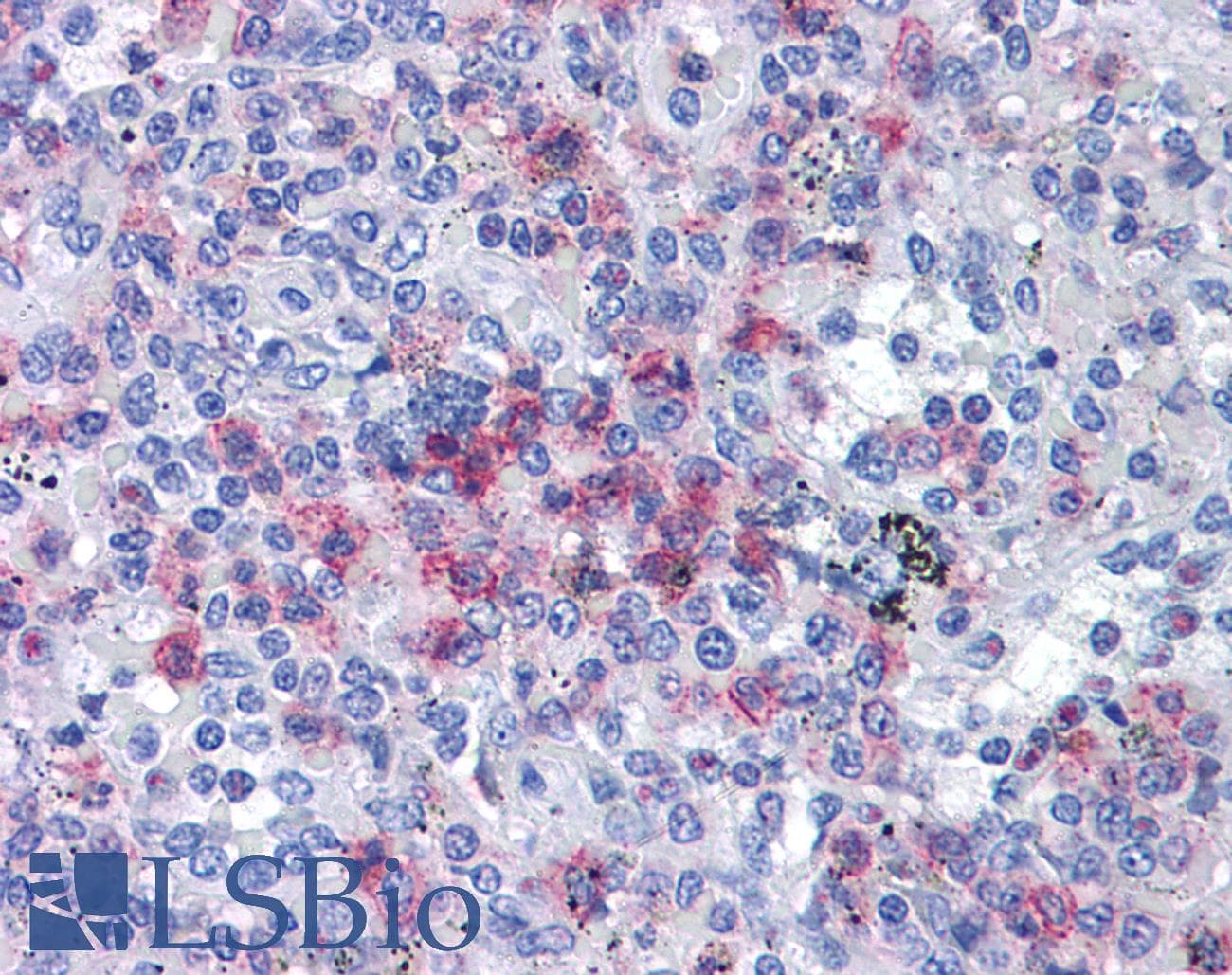 IHC-plus™ Polyclonal Rabbit anti-Human SPI1 / PU.1 Antibody (IHC, WB)