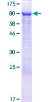 Human RAI2 Protein (Recombinant GST)