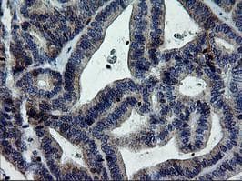 ERBB2 / HER2 Antibody (aa676-1255, clone OTI1A12, Carrier-free)
