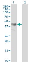 IHC-plus™ Monoclonal Mouse anti-Human ADRM1 Antibody (clone 3D11, IHC, WB)