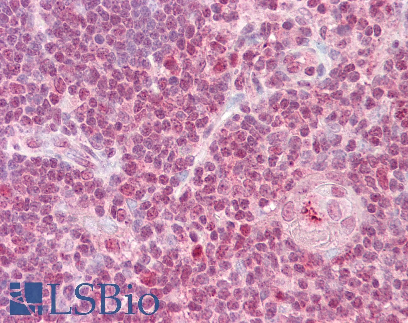 IHC-plus™ Polyclonal Rabbit anti-Human IRF4 Antibody (IHC, IF, WB)