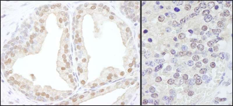 TRIM33 / TIF1-Gamma Antibody (aa650-700)