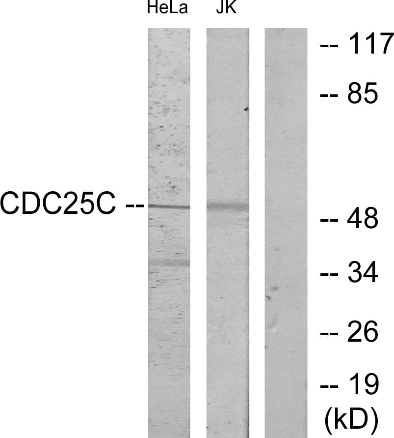 Polyclonal Rabbit anti-Human CDC25C Antibody (aa183-232, IHC, WB)