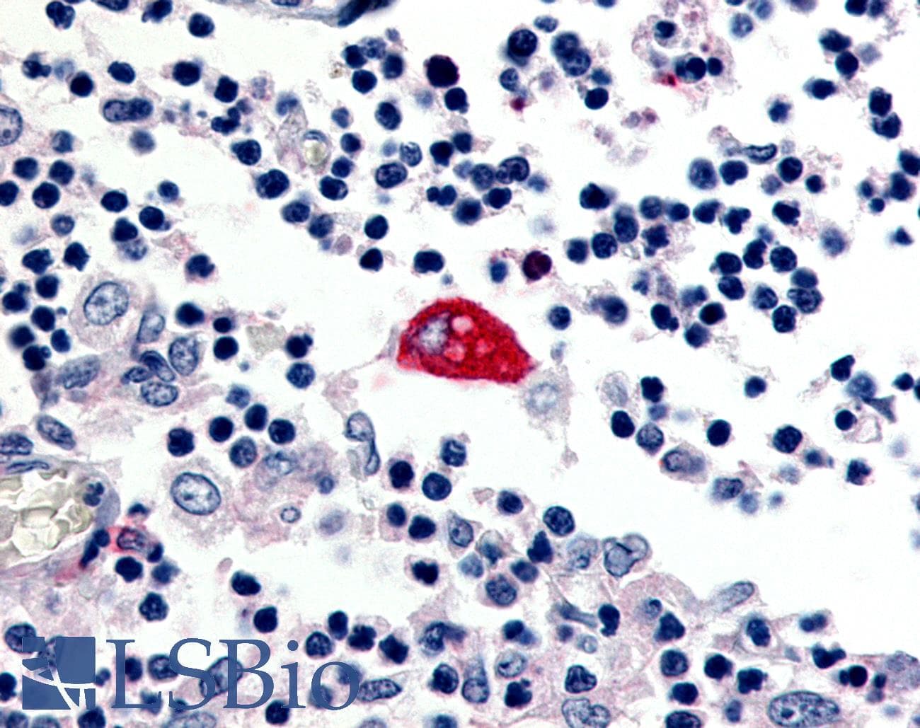 IHC-plus™ ADGRE3 / EMR3 Antibody (C-Terminus)