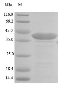 Human LAMB1 / Laminin Beta 1 Protein (Recombinant 6His-SUMO, N-terminus)