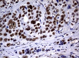 NBN / Nibrin Antibody (clone OTI2E9)