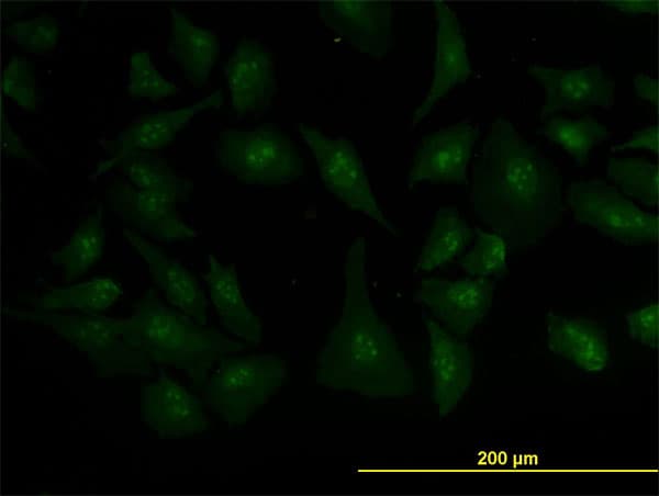 ZIC4 Antibody (clone 1A9)