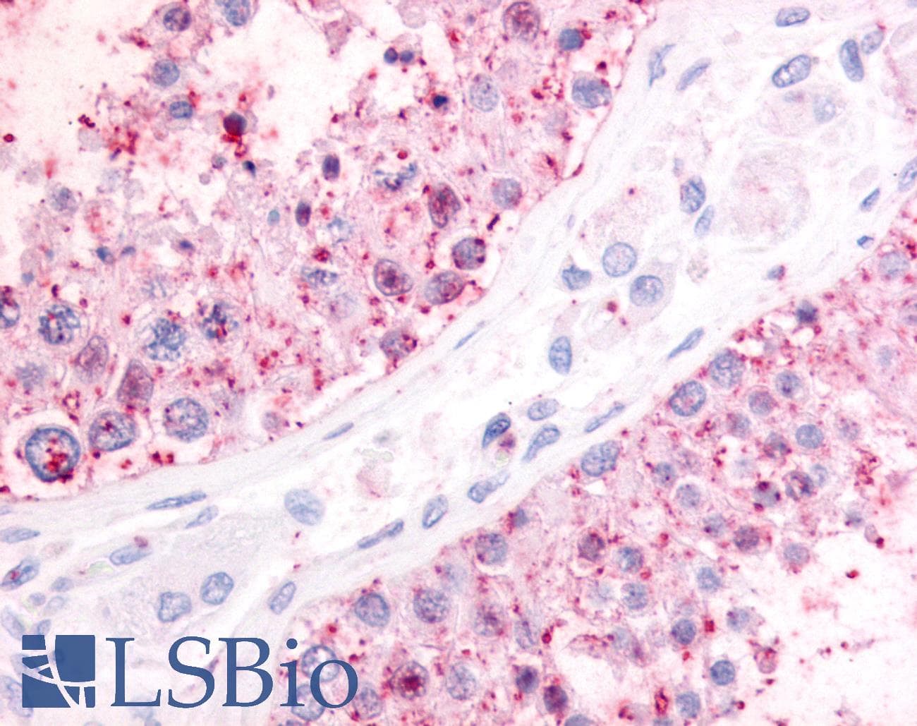 IHC-plus™ P2RY1 / P2Y1 Antibody (N-Terminus)