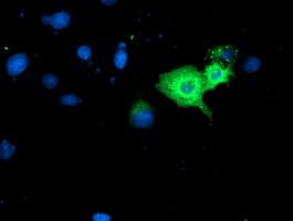Monoclonal Mouse anti-Human GBP1 Antibody (clone OTI1B2, IHC, IF, WB)