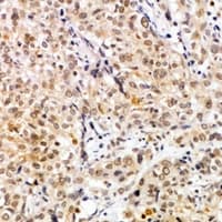 Polyclonal Rabbit anti-Human CARD10 / CARMA3 Antibody (IHC, WB)