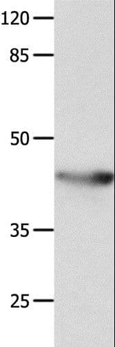 KCNA5 / Kv1.5 Antibody