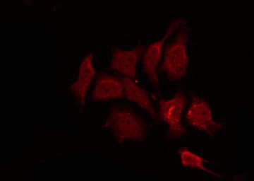 EGFR Antibody (phospho-Thr693)