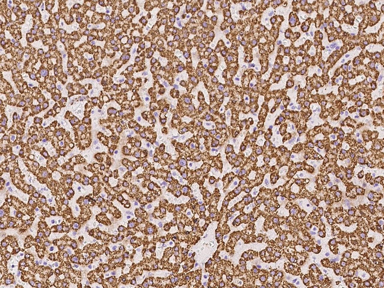 Polyclonal Rabbit anti-Human Rhodanese / TST Antibody (IHC, IF, WB)