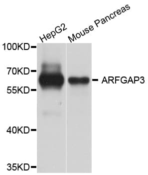 ARFGAP3 Antibody (AP)