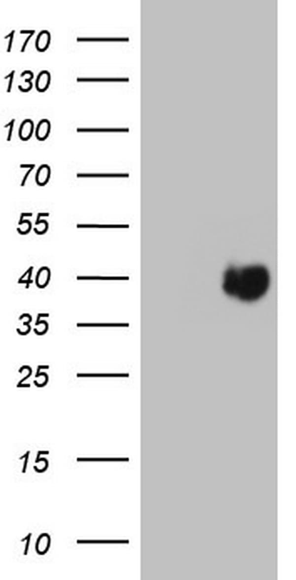 Monoclonal Mouse anti-Human PAGE1 Antibody (clone OTI10E7, IHC, WB)
