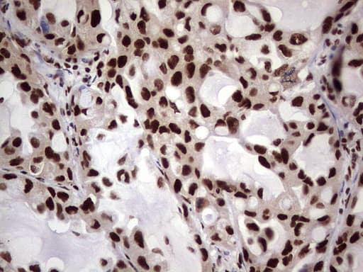 C14orf166 Antibody (clone OTI1E5)
