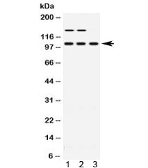 Polyclonal Rabbit anti-Human ACTN3 Antibody (IHC, WB)