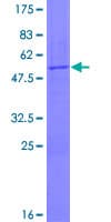 Human POP4 Protein (Recombinant GST)