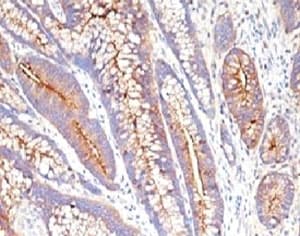 CEA / Carcinoembryonic Antigen Antibody (clone CCM661)