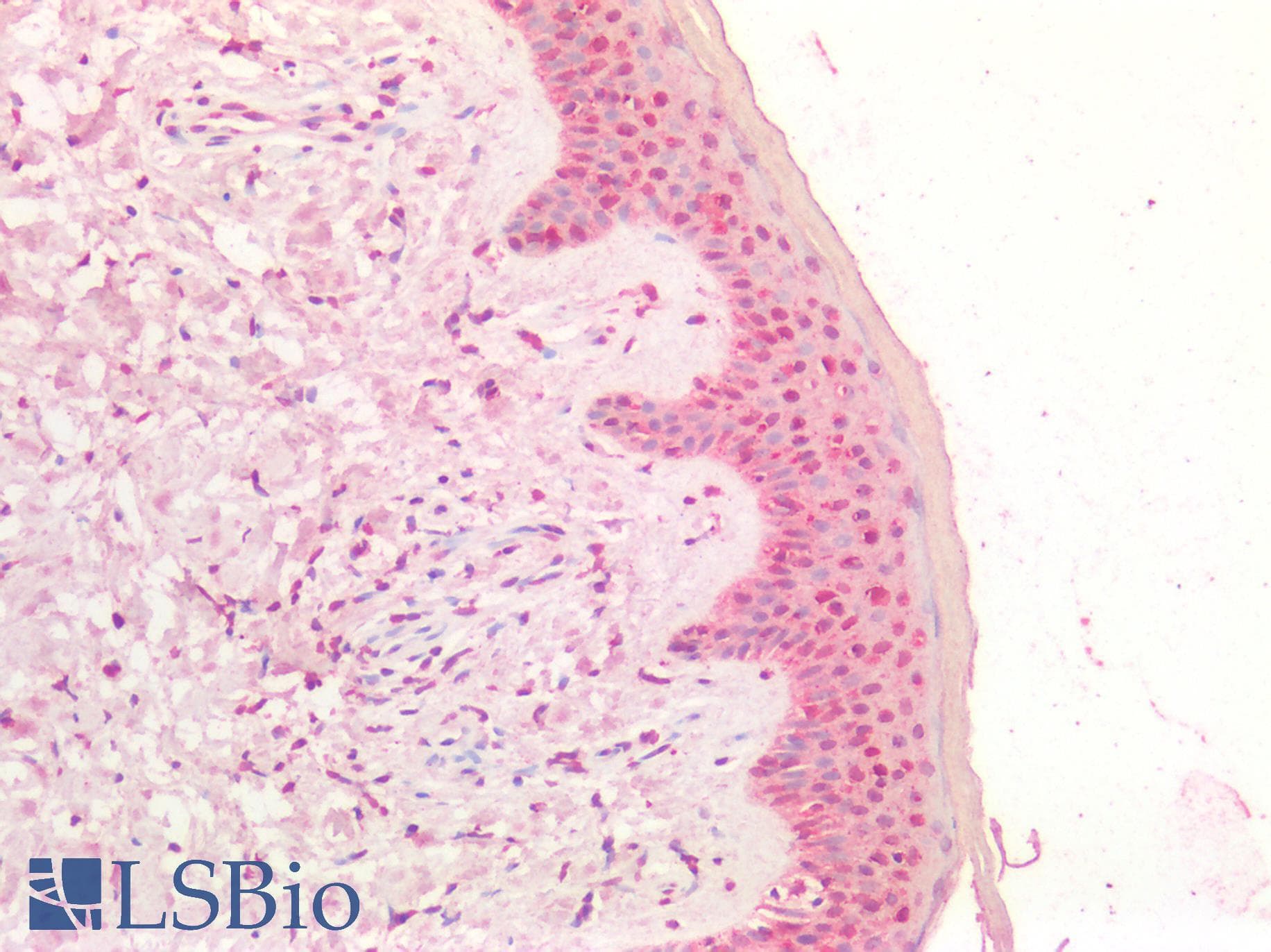 IHC-plus™ MYC / c-Myc Antibody