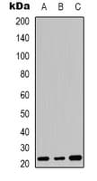 Polyclonal Rabbit anti-Human FGF20 Antibody (Internal, WB)