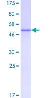 Human LGALS3 / Galectin 3 Protein (Recombinant GST)