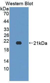 SLC1A6 / EAAT4 Antibody (aa156-264)