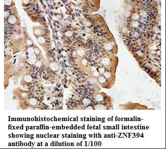 ZNF394 Antibody (aa163-345)