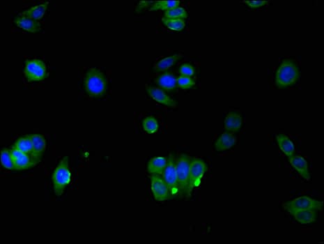 Polyclonal Rabbit anti-Human RAB3IP / RABIN3 Antibody (IHC, IF)