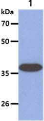 ARG2 / Arginase 2 Antibody (clone AT7F8)
