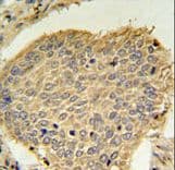 Polyclonal Rabbit anti-Human TRAPPC6A Antibody (aa34-62, IHC, WB)