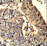 Polyclonal Rabbit anti-Human TSPEAR Antibody (aa293-320, IHC, WB)