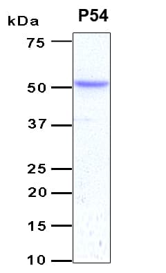 Human ETS1 / ETS-1 Protein (Recombinant 6His, N-terminus)
