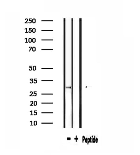 RPS2 / Ribosomal Protein S2 Antibody