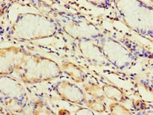 TLR1 Antibody