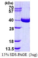 Human NAGK Protein (Recombinant His)