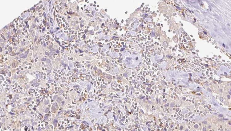 Polyclonal Rabbit anti-Human REEP6 Antibody (IHC, WB)