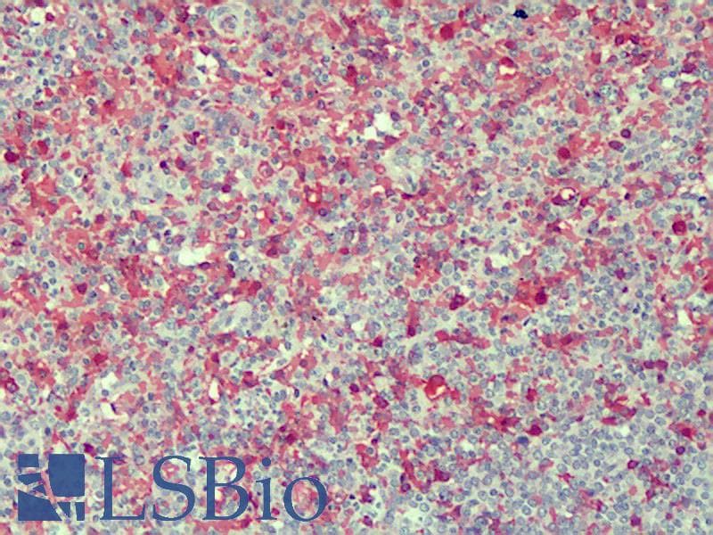 IHC-plus™ RCAN2 / RCN2 Antibody